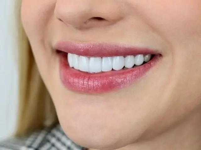 Primer plano de una nueva sonrisa — Smile Dental Center