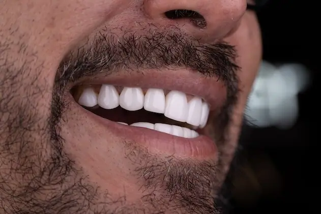 Sonrisa natural después de un tratamiento estético