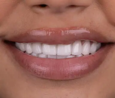Sonrisa de paciente de Smile Dental Center