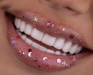 Sonrisa de paciente de Smile Dental Center