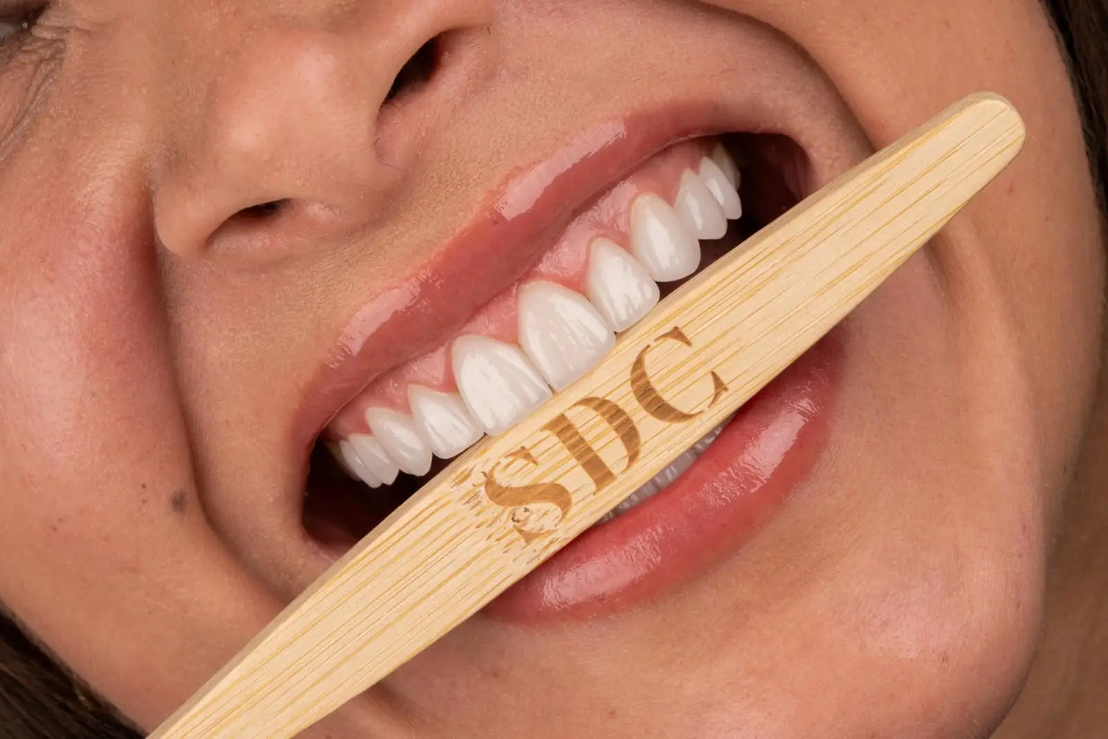 Resultado de Diseño Digital de Sonrisa — Smile Dental Center