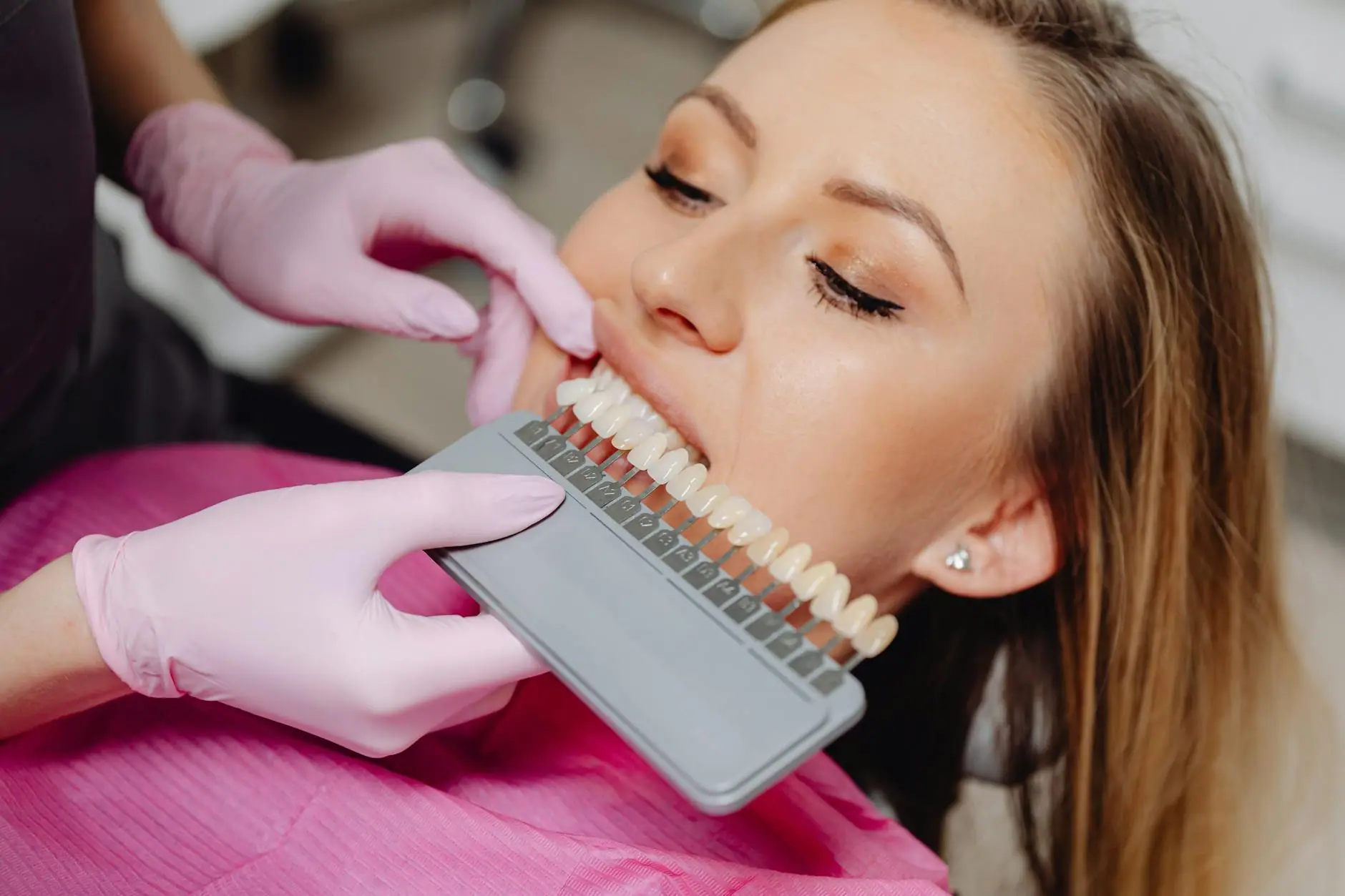 Toma de color antes de un blanqueamiento dental